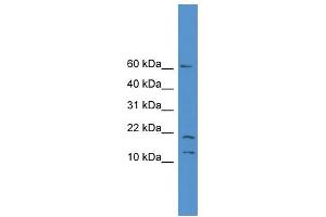 WB Suggested Anti-SNAPC5 Antibody Titration: 0. (SNAPC5 抗体  (N-Term))