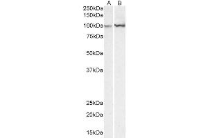 Western Blotting (WB) image for anti-Actinin, alpha 1 (ACTN1) (AA 596-609) antibody (ABIN5857549) (ACTN1 抗体  (AA 596-609))