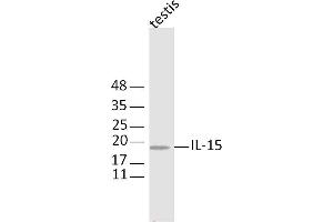 Mouse testis lysates probed with IL-11 Polyclonal Antibody, Unconjugated  at 1:300 dilution and 4˚C overnight incubation. (IL-11 抗体  (AA 22-120))