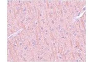Immunohistochemistry of CCDC106 in rat brain tissue with CCDC106 antibody at 5 μg/ml. (CCDC106 抗体  (C-Term))