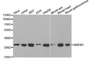 Western blot analysis of extracts of various cell lines, using AKR1B1 antibody. (AKR1B1 抗体  (AA 1-316))