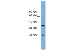 DOK6 antibody used at 1 ug/ml to detect target protein. (DOK6 抗体  (Middle Region))