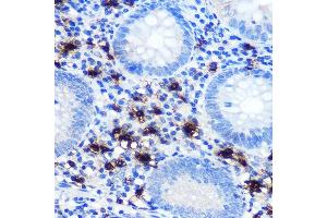 Immunohistochemistry of paraffin-embedded human appendix using Mast Cell Chymase (CM) (CM) Rabbit mAb (1480) at dilution of 1:100 (40x lens). (CMA1 抗体)