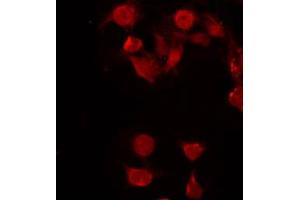 ABIN6272298 staining COLO205 by IF/ICC. (FUBP3 抗体  (Internal Region))