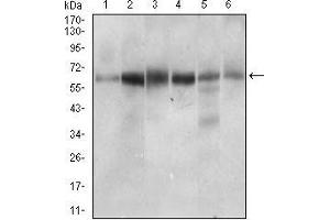Western Blotting (WB) image for anti-Catenin, beta Like 1 (CTNNBL1) (AA 390-557) antibody (ABIN2682986)