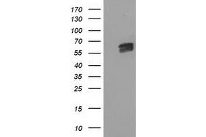 HEK293T cells were transfected with the pCMV6-ENTRY control (Left lane) or pCMV6-ENTRY EXD1 (Right lane) cDNA for 48 hrs and lysed. (EXD1 抗体)