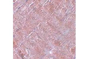 Immunohistochemical staining of human skeletal muscle tissue with RANBP10 polyclonal antibody  at 5 ug/mL dilution. (RANBP10 抗体  (Internal Region))