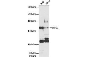 Western blot analysis of extracts of various cell lines, using LRIG1 antibody (ABIN6293213) at 1:3000 dilution. (Lrig1 抗体)