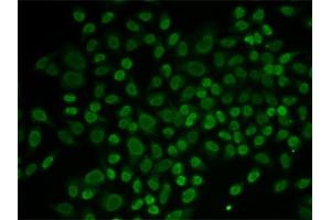 Immunofluorescence (IF) image for anti-RAD54-Like 2 (RAD54L2) antibody (ABIN1877130) (ARIP4 抗体)