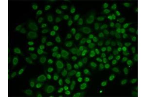 Immunofluorescence (IF) image for anti-RAD54-Like 2 (RAD54L2) antibody (ABIN1877130) (ARIP4 抗体)