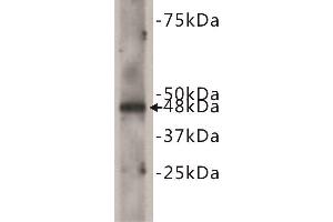 Western Blotting (WB) image for anti-Cadherin EGF LAG Seven Pass G-Type Receptor 2 (CELSR2) antibody (ABIN1854843) (CELSR2 抗体)