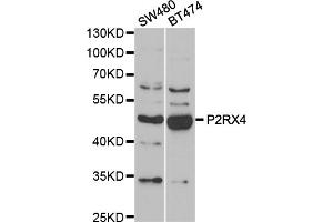 Western blot analysis of extracts of various cell lines, using P2RX4 antibody (ABIN5974027) at 1/1000 dilution. (P2RX4 抗体)