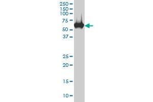 CES2 monoclonal antibody (M02), clone 4F12 Western Blot analysis of CES2 expression in HepG2 . (CES2 抗体  (AA 514-621))