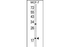 Western blot analysis of ARF3 antibody (Center D93) in MCF-7 cell line lysates (35ug/lane) (ARF3 抗体  (AA 78-106))