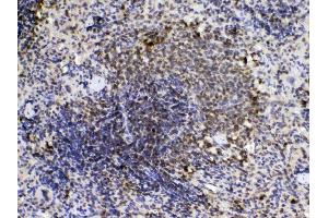 Immunohistochemistry (IHC) image for anti-Peptidylprolyl Isomerase A (Cyclophilin A) (PPIA) (AA 116-165) antibody (ABIN5518864)
