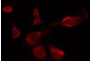 ABIN6277846 staining HepG2 by IF/ICC. (INSRR 抗体  (N-Term))