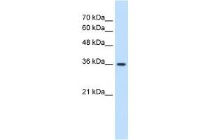 MAS1 antibody used at 1. (MAS1 抗体  (Middle Region))