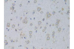 Immunohistochemistry of paraffin-embedded rat brain using GARS antibody. (GARS 抗体  (AA 60-370))