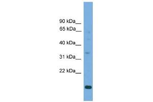 WB Suggested Anti-SLC25A44 Antibody Titration:  0. (SLC25A44 抗体  (Middle Region))