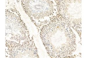 ABIN7094770 and ABIN7098821 at 1/100 staining Rat testis tissue by IHC-P.