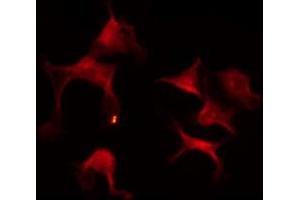 Immunofluorescence (fixed cells) (IF/ICC) image for anti-Signal Transducing Adaptor Molecule (SH3 Domain and ITAM Motif) 2 (STAM2) antibody (ABIN6265306)