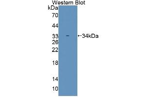 Western blot analysis of the recombinant protein. (SMUG1 抗体  (AA 1-270))