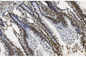 IHC analysis of U2AF65/U2AF2 using anti U2AF65/U2AF2 antibody (ABIN7600795). (U2AF2 抗体  (AA 238-470))