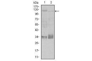 Image no. 2 for anti-Integrin beta 1 (ITGB1) antibody (ABIN1498893) (ITGB1 抗体)