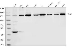 Western blot analysis of HDAC4 using anti-HDAC4 antibody (ABIN5518841). (HDAC4 抗体  (AA 4-213))