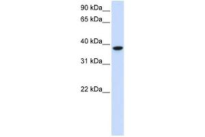 GLT8D2 antibody used at 1 ug/ml to detect target protein. (GLT8D2 抗体  (C-Term))