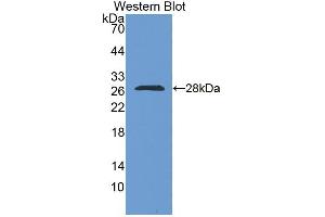 Western blot analysis of the recombinant protein. (RBM38 抗体  (AA 25-207))