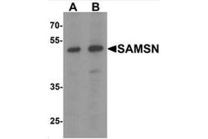 Western blot analysis of SAMSN in Hela cell lysate with SAMSN Antibody  at (A) 0. (SAMSN1 抗体  (C-Term))