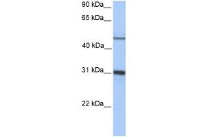 Western Blotting (WB) image for anti-Epoxide Hydrolase 1, Microsomal (Xenobiotic) (EPHX1) antibody (ABIN2459723) (EPHX1 抗体)