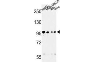 Western Blotting (WB) image for anti-Microtubule Associated serine/threonine Kinase-Like (MASTL) antibody (ABIN3003015) (MASTL 抗体)