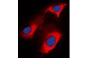 Immunofluorescent analysis of APC staining in HeLa cells.