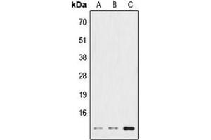 Western blot analysis of HSPE1 expression in HeLa (A), NIH3T3 (B), PC12 (C) whole cell lysates.