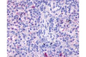 Anti-FPR3 / FPRH2 antibody IHC of human spleen. (FPR3 抗体  (Transmembrane Domain))