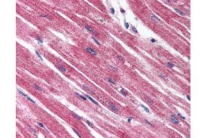 Immunohistochemistry (IHC) image for anti-Endothelin Receptor Type A (EDNRA) (Extracellular Domain) antibody (ABIN1048554)