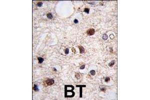 Formalin-fixed and paraffin-embedded human brain tissue reacted with JMJD3 (N-term) (ABIN387862 and ABIN2844039) , which was peroxidase-conjugated to the secondary antibody, followed by DAB staining. (Kdm6b 抗体  (N-Term))