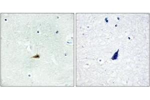 Immunohistochemistry analysis of paraffin-embedded human brain tissue, using NCOR2 Antibody. (NCOR2 抗体  (AA 511-560))