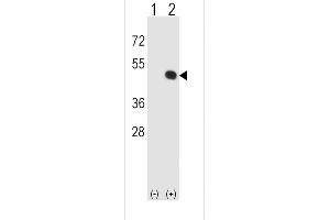 Western blot analysis of HLA-E using rabbit polyclonal HLA-E Antibody using 293 cell lysates (2 ug/lane) either nontransfected (Lane 1) or transiently transfected (Lane 2) with the HLA-E gene. (HLA-E 抗体  (AA 108-135))