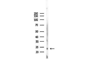 anti-Mitochondrial Ribosomal Protein L13 (MRPL13) (C-Term) antibody
