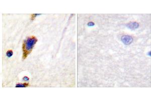 Peptide - +Immunohistochemical analysis of paraffin-embedded human brain tissue using Dynamin-1 (Ab-774) Antibody (#B0422). (Dynamin 1 抗体  (Ser774))