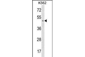 ME1 Antibody (C-term) (ABIN1537187 and ABIN2848923) western blot analysis in K562 cell line lysates (35 μg/lane). (PPME1 抗体  (C-Term))
