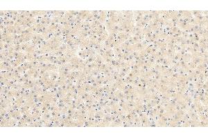 Detection of VEGF165 in Porcine Liver Tissue using Monoclonal Antibody to Vascular Endothelial Growth Factor 165 (VEGF165) (VEGF 165 (AA 28-191) 抗体)