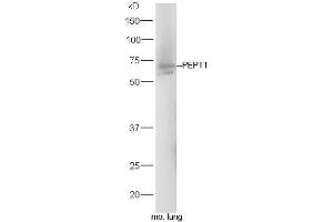 Western Blotting (WB) image for anti-Solute Carrier Family 15 (Oligopeptide Transporter), Member 1 (SLC15A1) (AA 421-520) antibody (ABIN2559661)