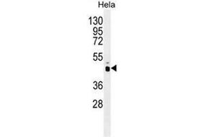 PRKAG1 Antibody (N-term) western blot analysis in Hela cell line lysates (35µg/lane). (PRKAG1 抗体  (N-Term))