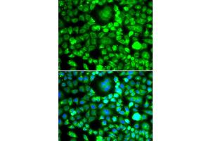 Immunofluorescence analysis of MCF-7 cells using BLID antibody (ABIN4903053). (BLID 抗体)