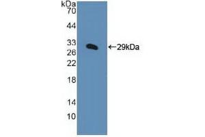 Detection of Recombinant KPNa1, Human using Polyclonal Antibody to Karyopherin Alpha 1 (KPNa1) (KPNA1 抗体  (AA 239-506))