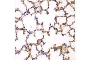 Immunohistochemistry of paraffin-embedded mouse lung using EPB41 antibody at dilution of 1:200 (400x lens). (EPB41 抗体)